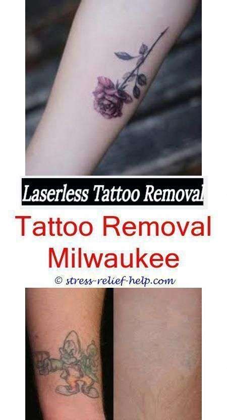 tattoo ink how to remove tattoos at home for free