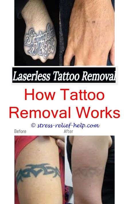 tattoo lightening is hair removal cream bad for tattoos ...