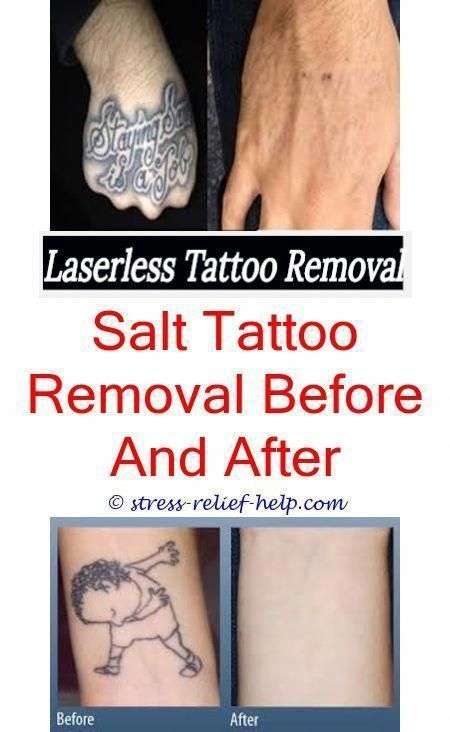 tattoo lightening lemon and salt tattoo removal