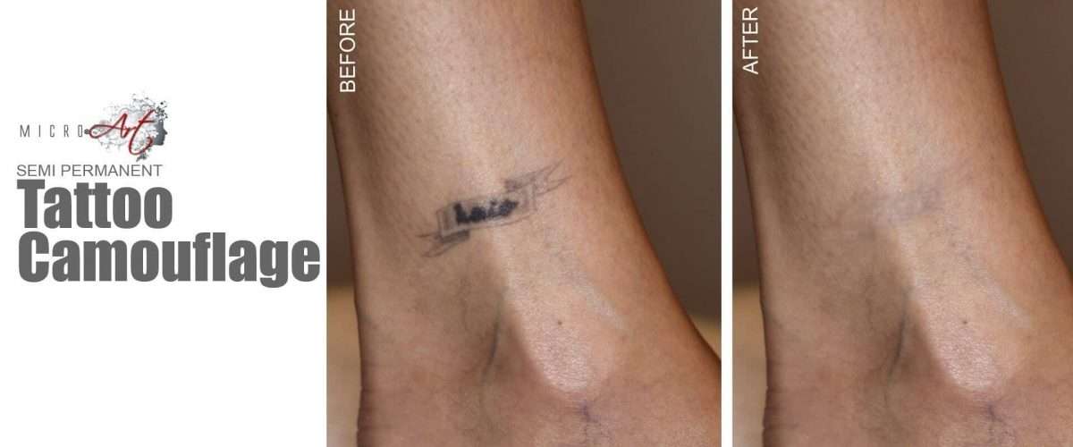 Tattoo Removal Alternative by MicroArt Semi Permanent Makeup