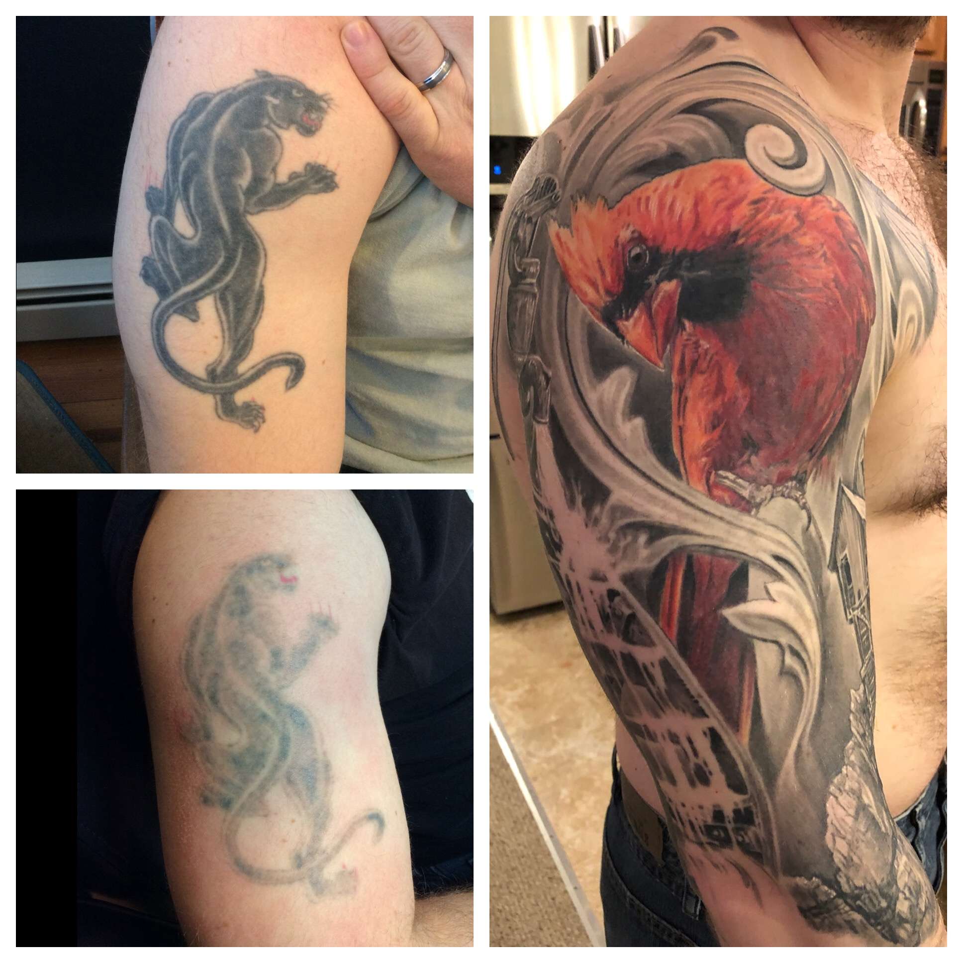 Tattoo Removal Before And After Photos At Disappearing Inc