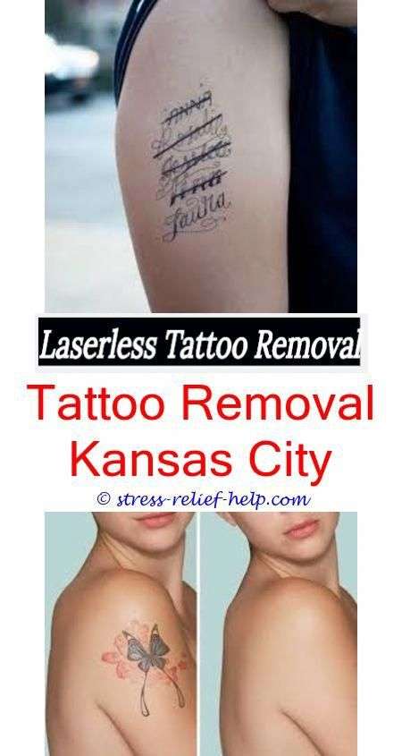 tattoo removal cost how much does a tattoo removal hurt