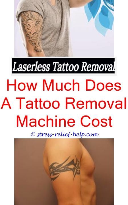 Tattoo removal cream does it work.How to remove your own tattoo.How to ...