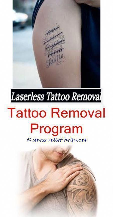 tattoo removal cream how soon can i get a color tattoo removed