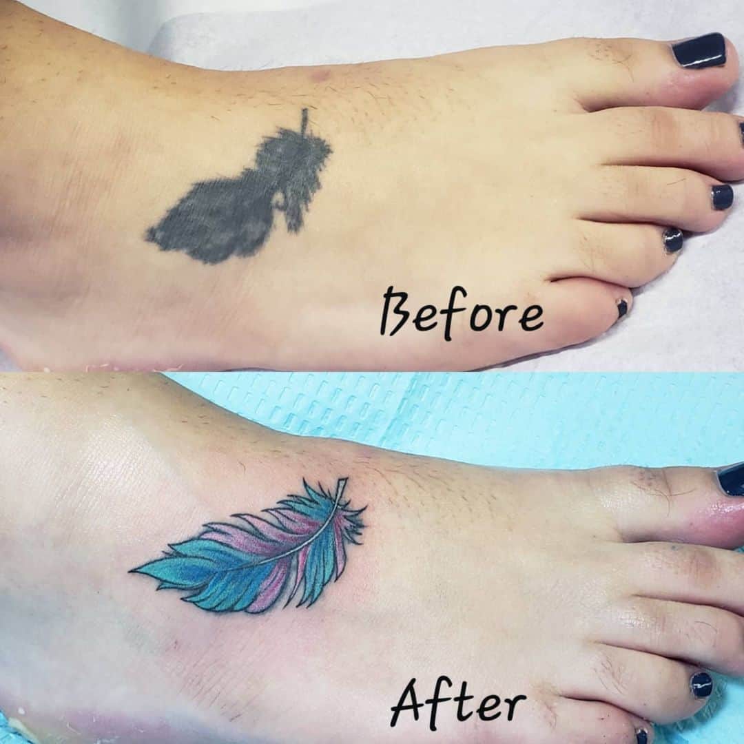 Tattoo Removal: Everything You Should Know (Before You Get a Tatt ...