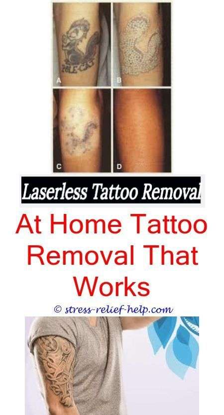 Tattoo removal hawaii.Eraze tattoo removal.Can you get ...