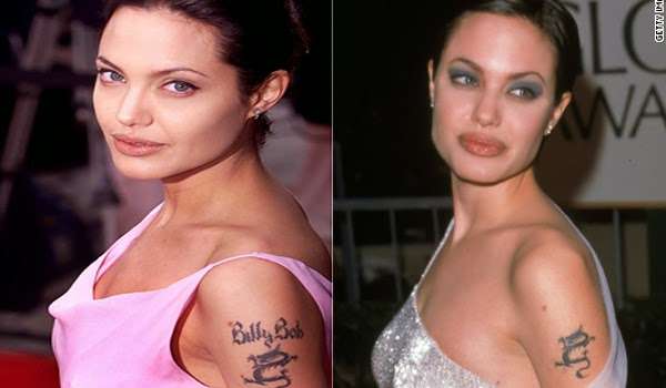 Tattoo Removal in New York City: Ex Celebrity Lovers That ...