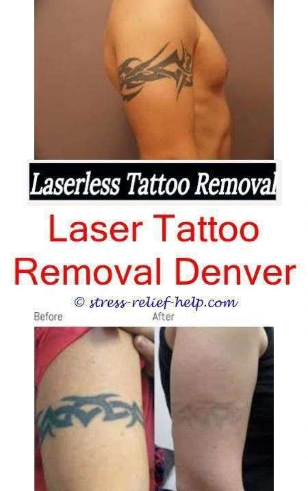 Tattoo removal michigan.How bad does tattoo removal hurt ...