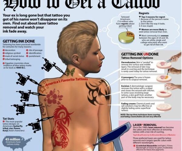 Tattoo Removal Options: Tips to Get Rid of Your Ink Safely