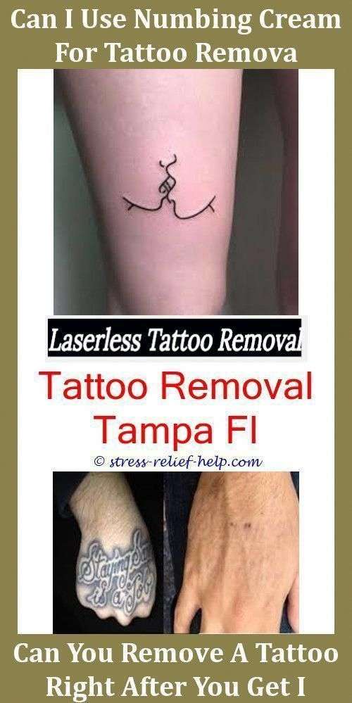 Tattoo Removal Prices Is Laser Hair Removal More Painful Than Tattoo ...