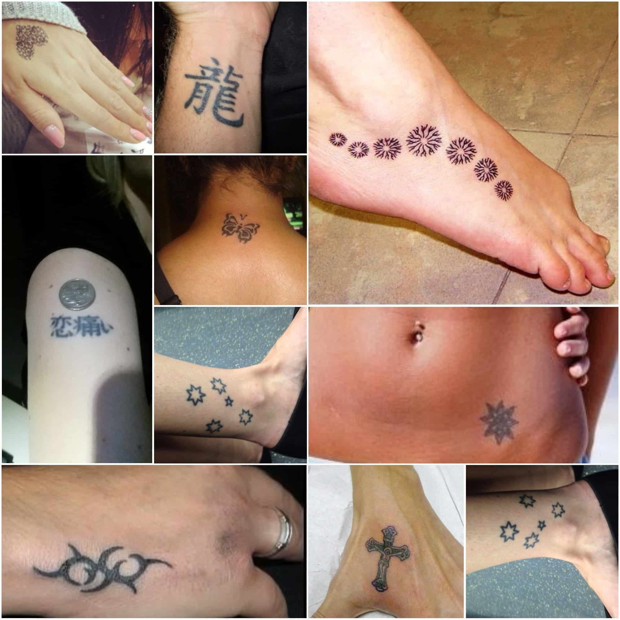 Tattoo Removal Pricing