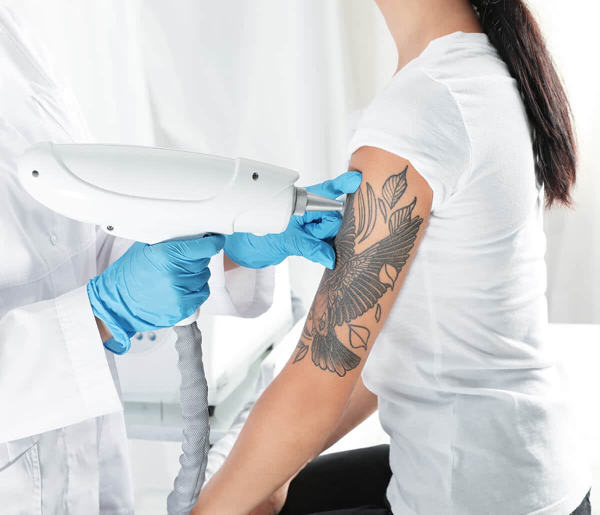 Tattoo Removal Procedure Jupiter FL