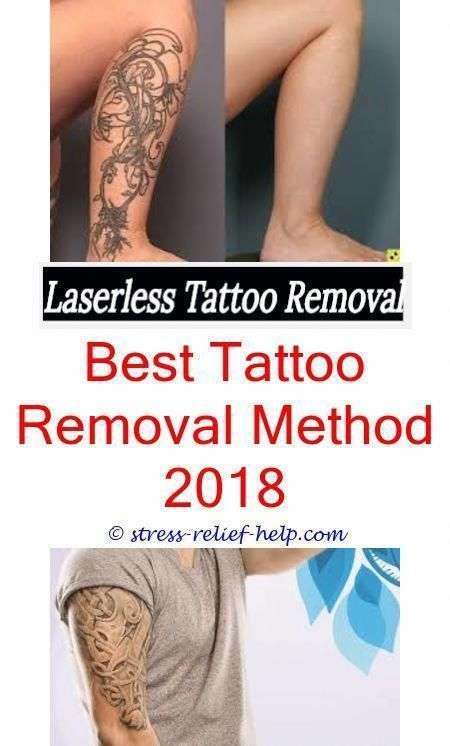 Tattoo removal reviews.What is the average cost of a tattoo removal.How ...