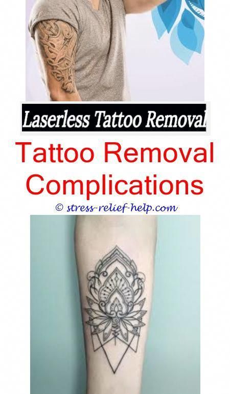 Tattoo removal san jose.How to remove triathlon tattoos.Is it possible ...