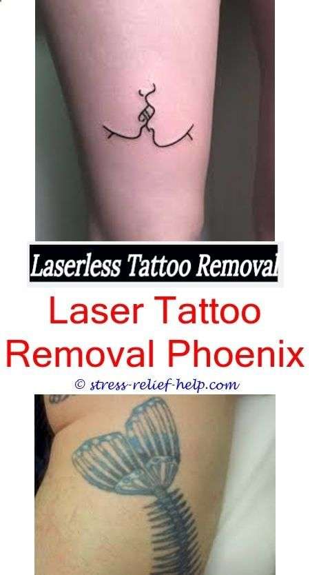 tattoo removal tattoo removal inland empire