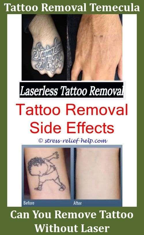 Tattoos Removal How To Numb Skin Before Tattoo Removal How Can You ...