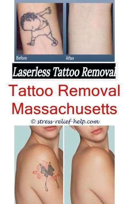 the best tattoo removal how long does it take to get laser tattoo ...