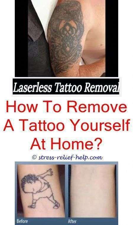 the best tattoo removal is it safe to get a tattoo removed while ...