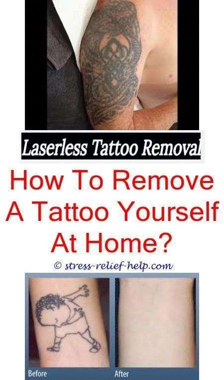 the best tattoo removal is it safe to get a tattoo removed ...
