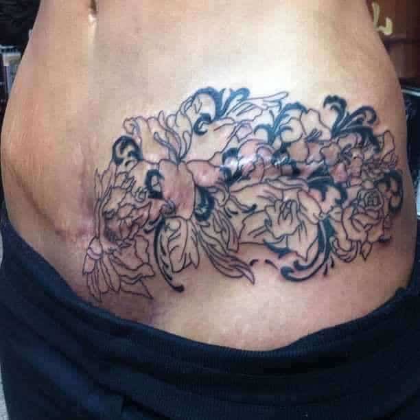 tummy tuck cover up tattoos » Tummy tuck information: prices, photos ...