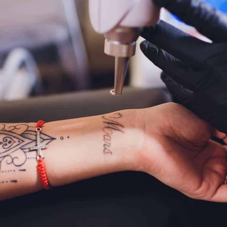 Types of Tattoo Removal Procedures  Self Tattoo