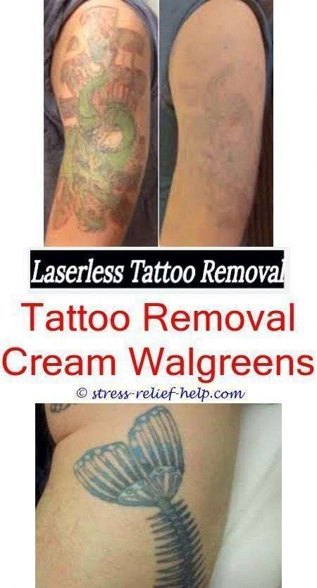 Where can I get a tattoo removed? How do you remove a permanent tattoo ...