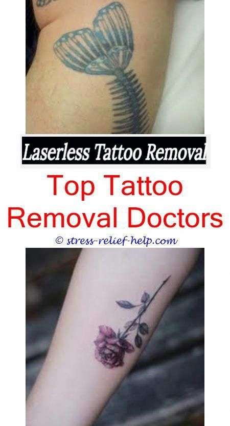 Where can i get my tattoo removed for free.Does bleaching cream remove ...