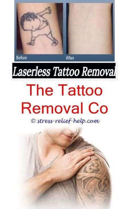 Where can i remove my tattoo.Tattoo removal bristol.The laserless ...