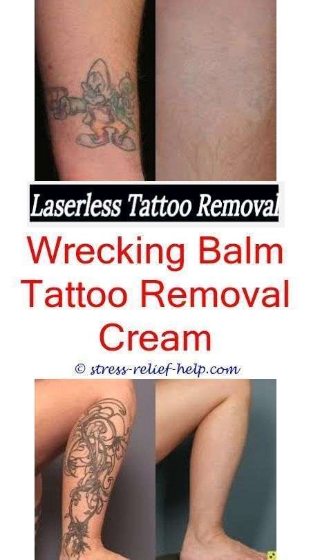 where to get a tattoo removed can you remove a tattoo at ...