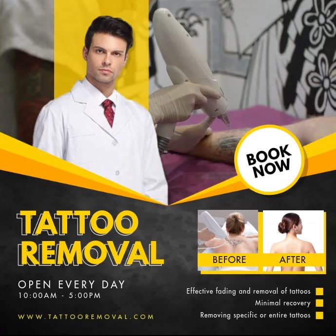 Yellow Laser Tattoo Removal Clinic Ad Template
