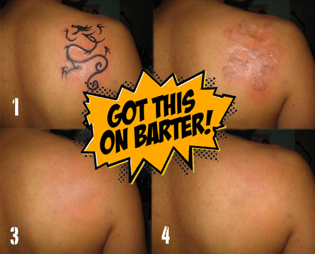 Yesterday we posted that you can get a tattoo on barter ...