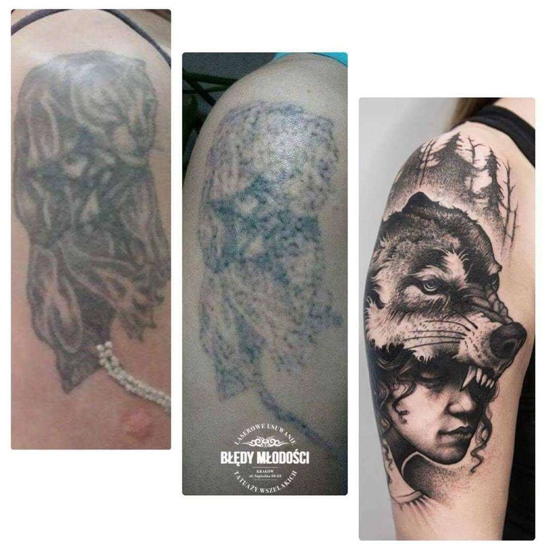 You can see the result after one session with laser tattoo ...